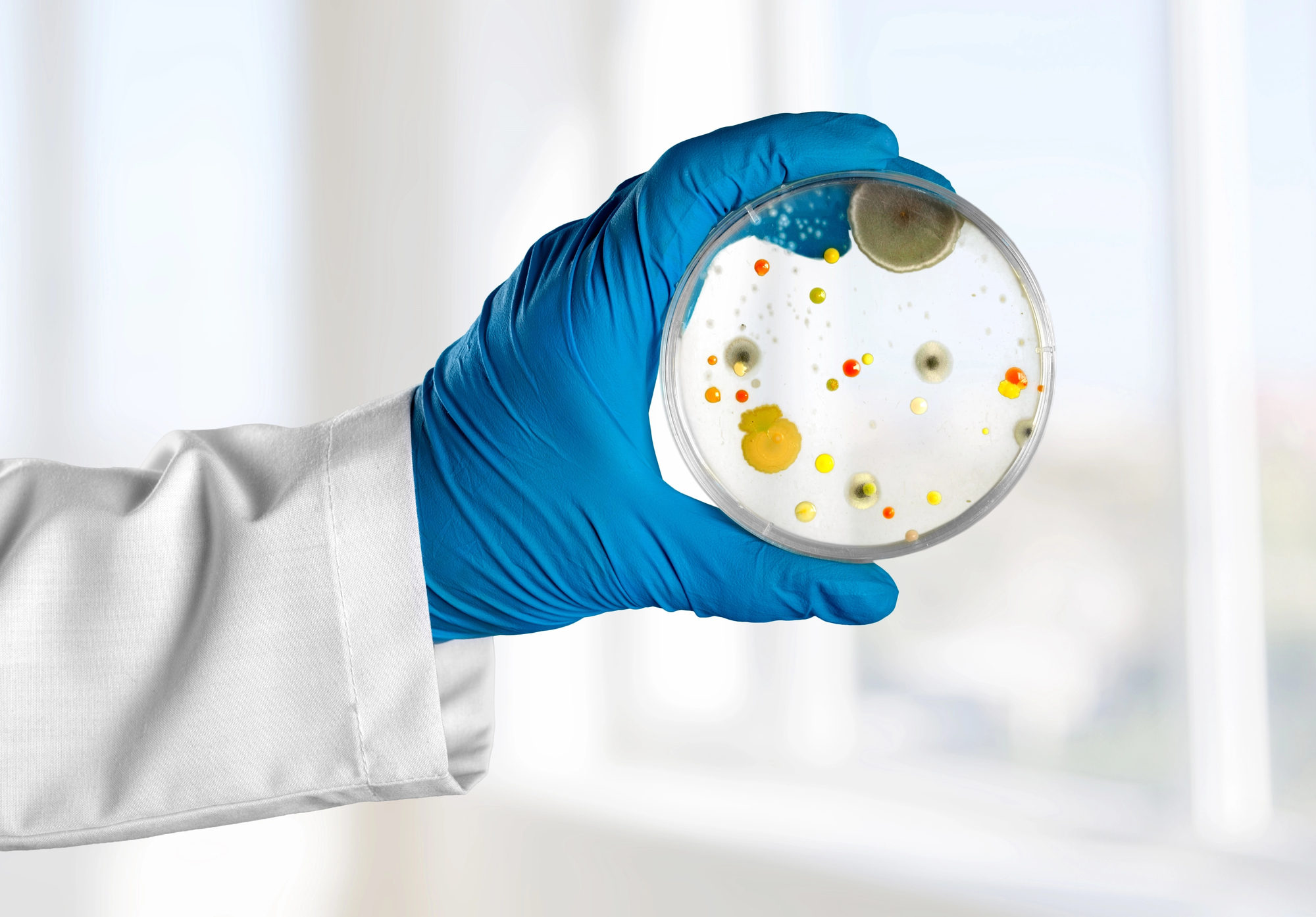 A person wearing a lab coat and blue gloves holds a petri dish containing various colorful bacterial or mold colonies against a bright background.