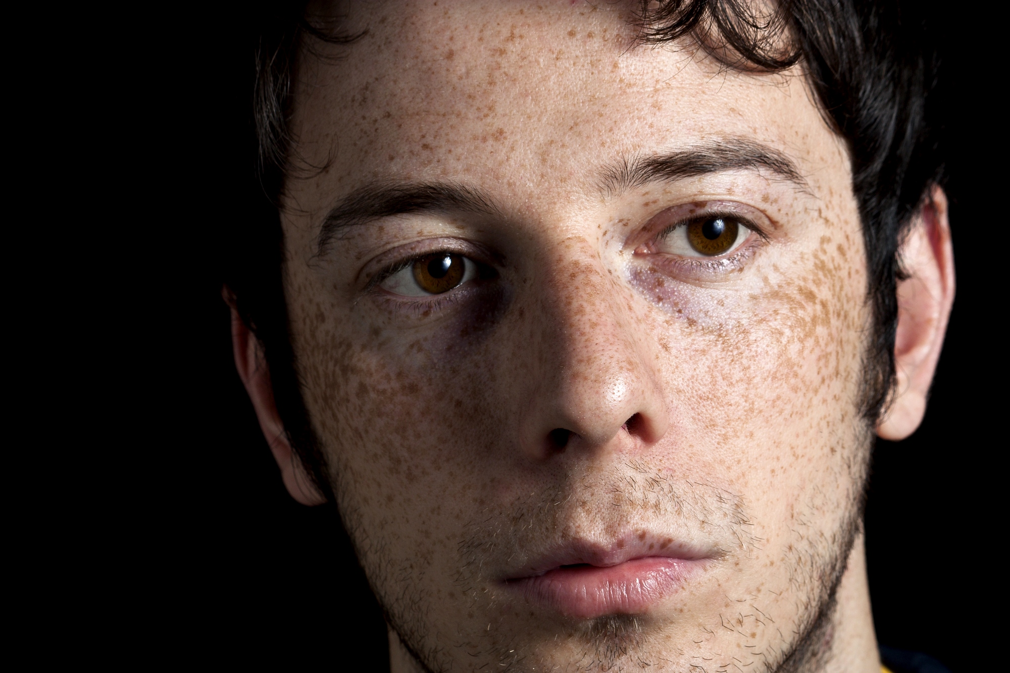 Close-up of a young man with fair skin, brown eyes, dark hair, and freckles. His expression is neutral, and he is looking slightly to the side. There is a black background behind him.