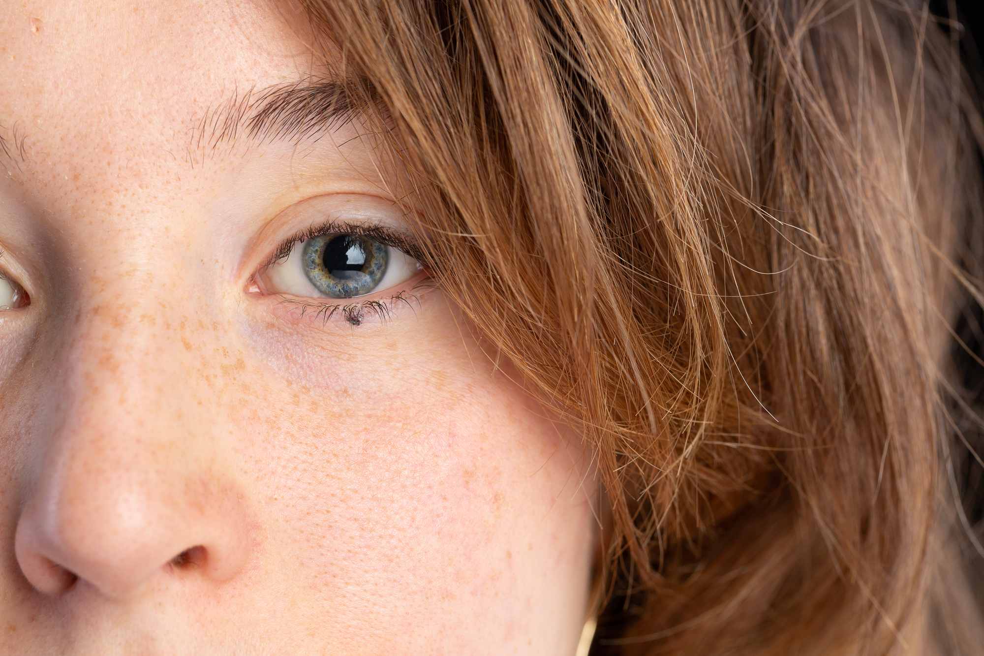 Close-up of a person's face showing their right eye, with light brown hair framing the face. The skin has freckles, and the eye is a light color. The background is dark and out of focus.